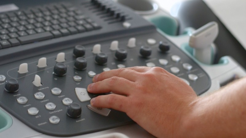 Hand am Ultraschallgerät